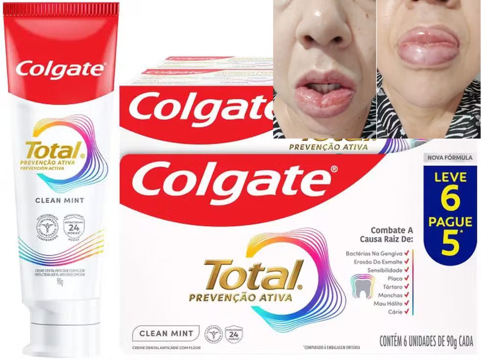 Embalagem do creme dental Colgate Total Prevenção Ativa Clean Mint suspenso pela Anvisa