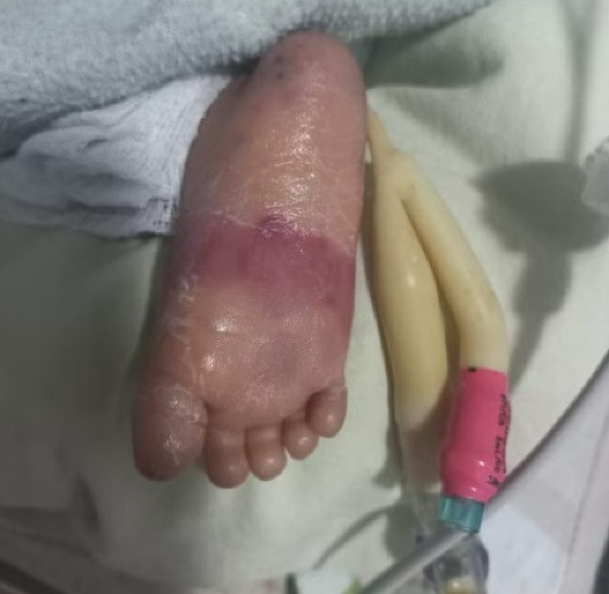 Hospital Santa Helena em Cuiabá, caso de morte de bebê em investigação.