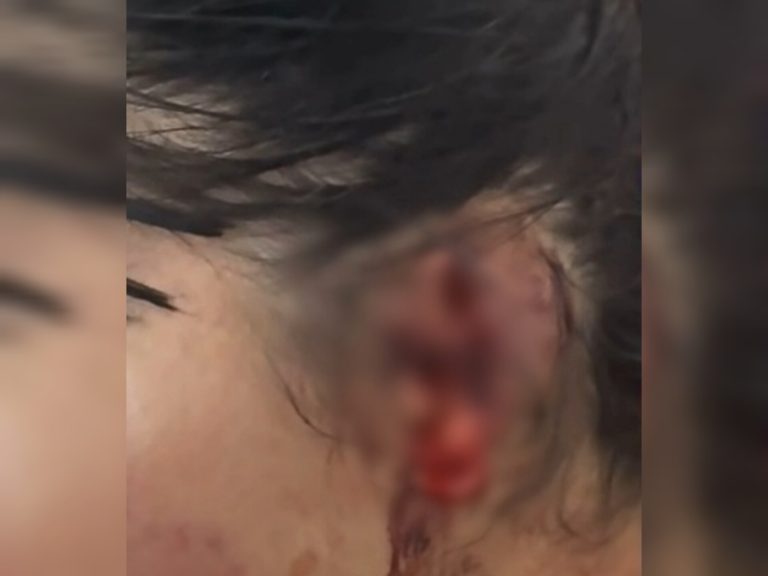 Viatura da Polícia Militar em ação após caso de violência doméstica em Primavera do Leste
