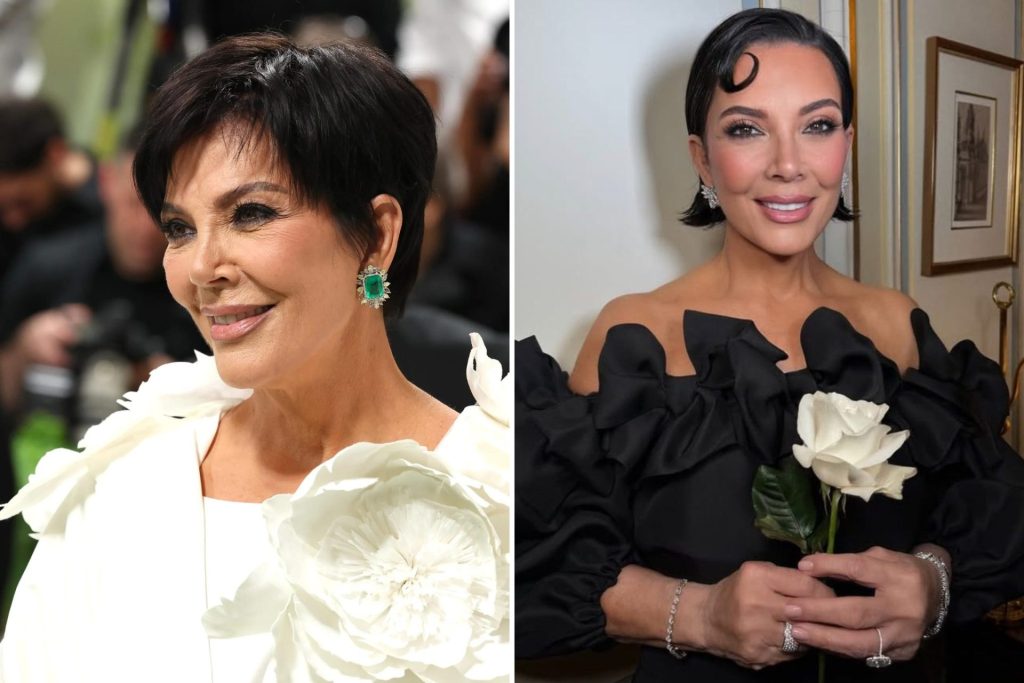 Kris Jenner com rosto rejuvenescido aos 69 anos